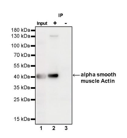 alpha smooth muscle Actin Recombinant Mouse mAb (SDT-R142)