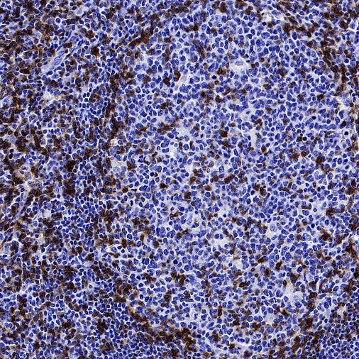 CD5 Recombinant Rabbit mAb (SDT-2857-16)