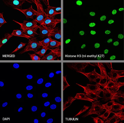 Histone H3 (tri methyl K27) Recombinant Rabbit mAb (S-4098)