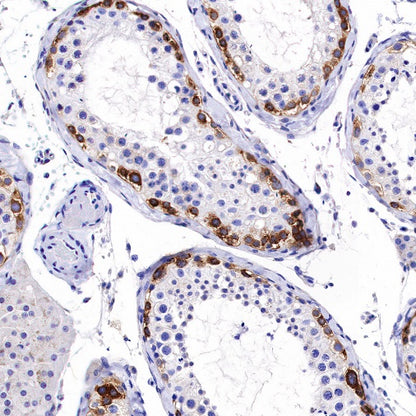 FMRP Recombinant Rabbit mAb (S-1671-1)
