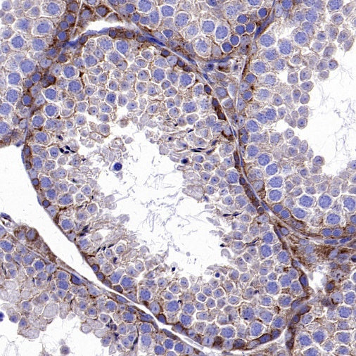 ATP7A Recombinant Rabbit mAb (S-2289-106)