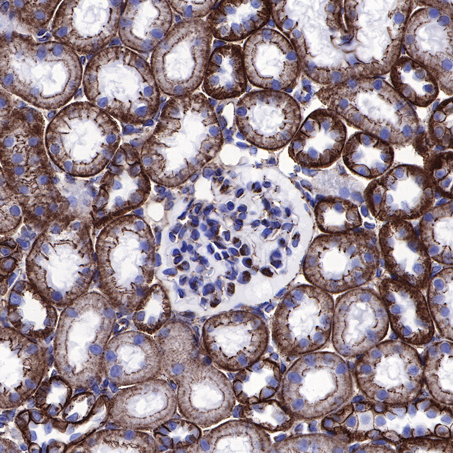 β-Catenin Recombinant Rabbit mAb,PBS Only (SDT-336-23)