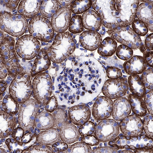 β-Catenin Recombinant Rabbit mAb,PBS Only (SDT-336-23)