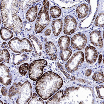 SDHA Recombinant Rabbit mAb (S-1458-43)