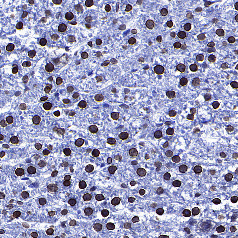 Lamin A/C Recombinant Rabbit mAb (S-5671)