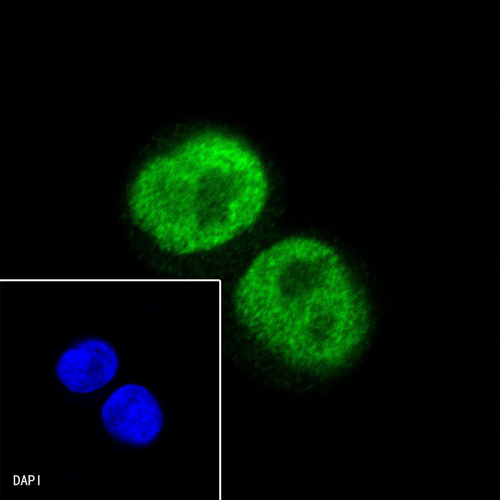 Androgen Receptor Recombinant Rabbit mAb (SDT-R157)
