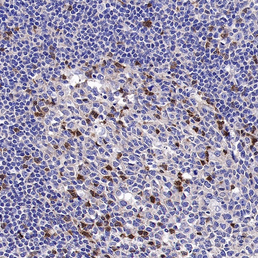 SH-PTP2 Recombinant Rabbit mAb (S-1318-2)