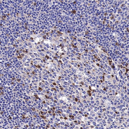 SH-PTP2 Recombinant Rabbit mAb (S-1318-2)