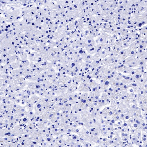 Claudin 6 Recombinant Rabbit mAb (S-521-63)