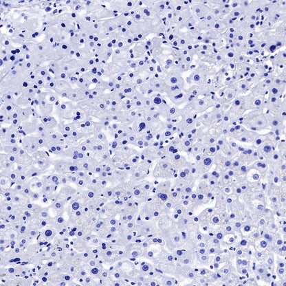 Claudin 6 Recombinant Rabbit mAb (S-521-63)