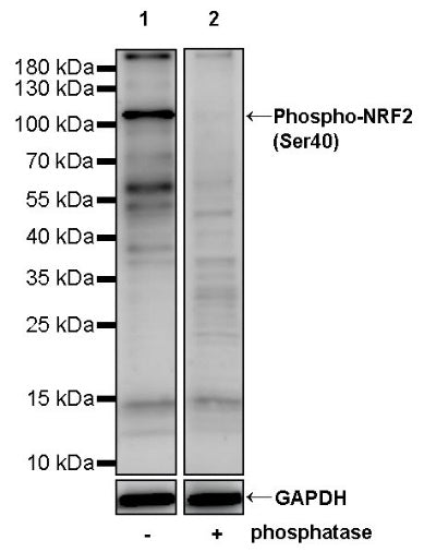 Phospho-NRF2 (Ser40) Recombinant Rabbit mAb (S-1720-97)