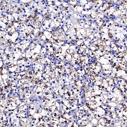 SOD2/MnSOD (acetyl K68) Rabbit Polyclonal Antibody