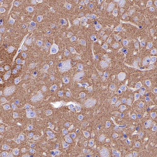 Pan Trk Recombinant Rabbit mAb (SDT-400-39)