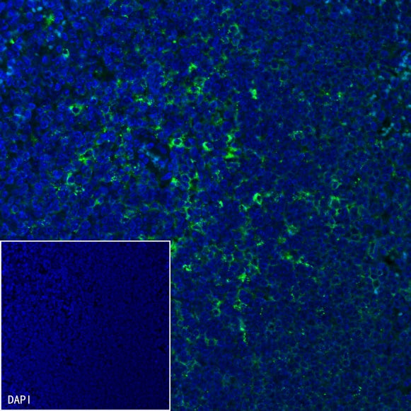 Rat Anti-Mouse I-A/I-E Antibody (M5/114.15.2)