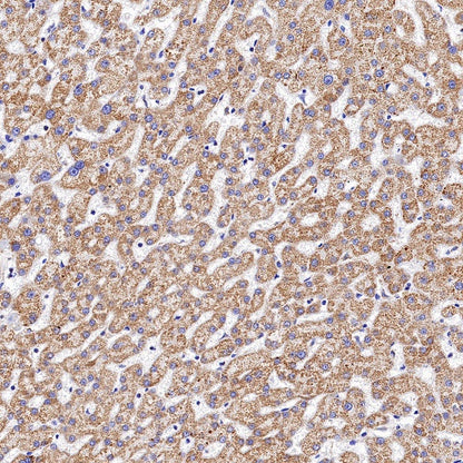 ATP5B Recombinant Rabbit mAb (S-1271-29)