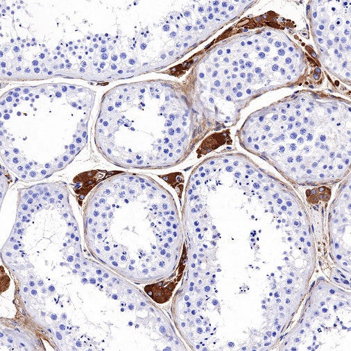 Apolipoprotein E/APOE Recombinant Rabbit mAb (S-970-75)