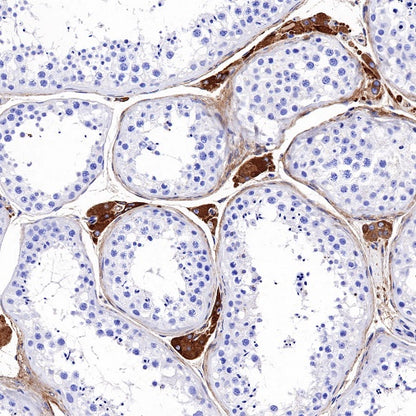 Apolipoprotein E/APOE Recombinant Rabbit mAb (S-970-75)