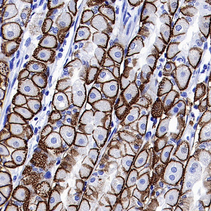 AQP4 Recombinant Rabbit mAb (S-1609-62)