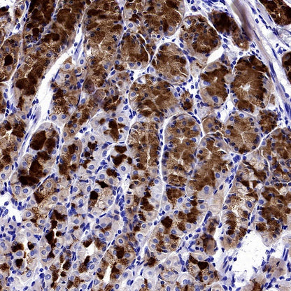 MYO7A Recombinant Rabbit mAb (S-2284-21)