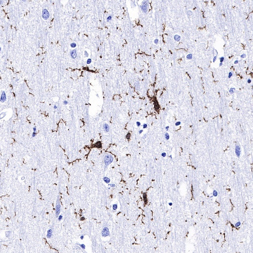 Iba1 Recombinant Rabbit mAb (S-484-18)