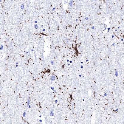 Iba1 Recombinant Rabbit mAb (S-484-18)