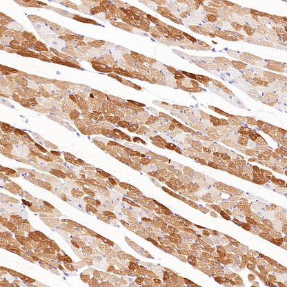 MYH7 Recombinant Rabbit mAb ,PBS Only (SDT-2936-44)