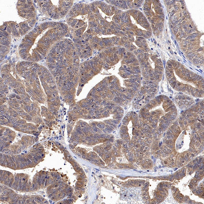 HPRT1 Rabbit Polyclonal Antibody