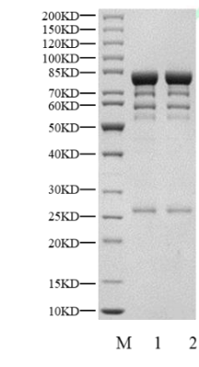 CaMK4 GST Tag Protein, Human