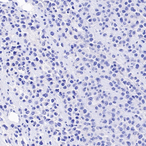 Tissue factor Recombinant Rabbit mAb (S-893-34)