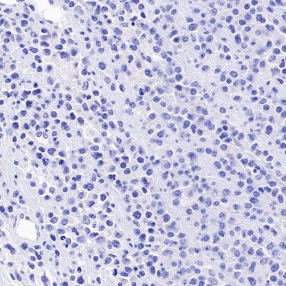 Tissue factor Recombinant Rabbit mAb (S-893-34)