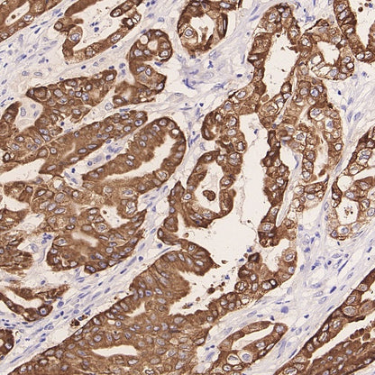 MUC5AC Recombinant Rabbit mAb (SDT-2630-23)