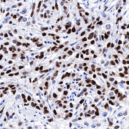 Progesterone Receptor Recombinant Rabbit mAb (SDT-R123)