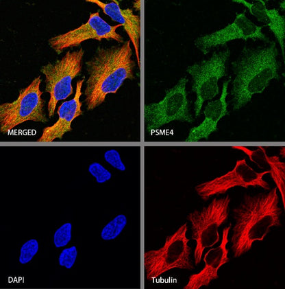 Vinculin Recombinant Rabbit mAb (S-1635-6)