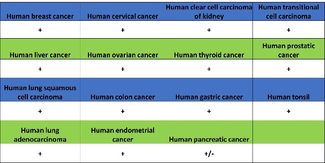Rictor Recombinant Rabbit mAb (S-2601-26)
