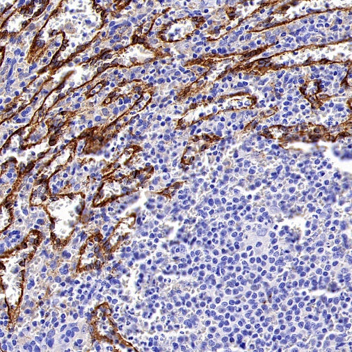 Mannose Receptor Recombinant Rabbit mAb (SDT-2206-59)