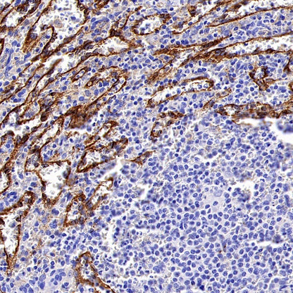 Mannose Receptor Recombinant Rabbit mAb (SDT-2206-59)