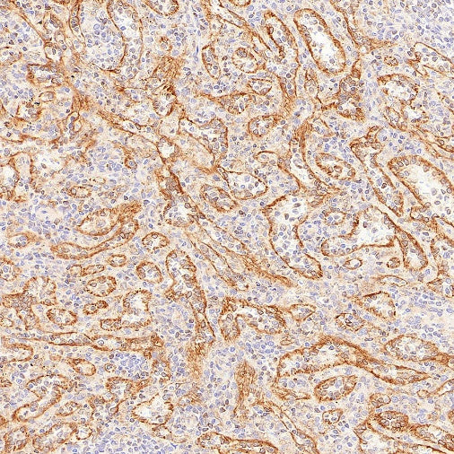 LPCAT1 Recombinant Rabbit mAb (S-6053)