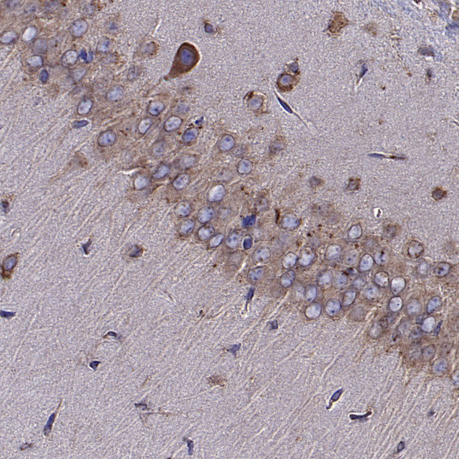 Calreticulin Recombinant Rabbit mAb (S-3920-39)