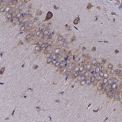 Calreticulin Recombinant Rabbit mAb (S-3920-39)
