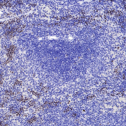 Phospho-Rb (Ser807/811) Recombinant Rabbit mAb (S-2215-52)