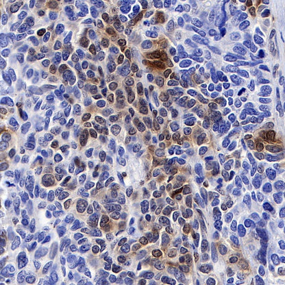 TFEB Recombinant Rabbit mAb (S-R296)