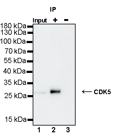 CDK5 Recombinant Rabbit mAb (S-1309-115)