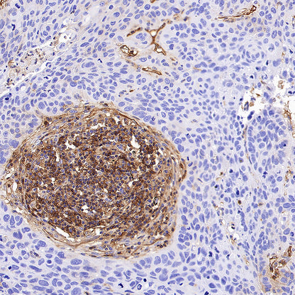 HLA-ABC Recombinant Rabbit mAb (S-3995-2)