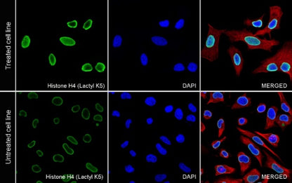 Histone H4 (Lactyl K5) Recombinant Rabbit mAb (S-3220-73)