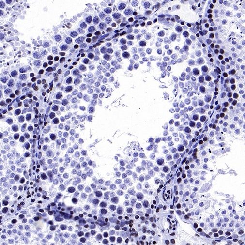 Cyclin E1 Recombinant Rabbit mAb (SDT-2512-182)