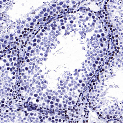 Cyclin E1 Recombinant Rabbit mAb (SDT-2512-182)