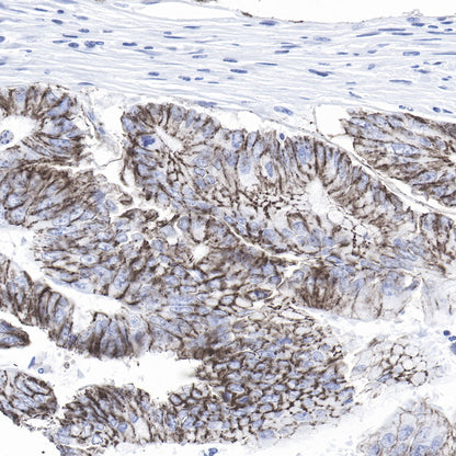 Claudin-1 Recombinant Rabbit mAb,PBS Only (SDT-R024)