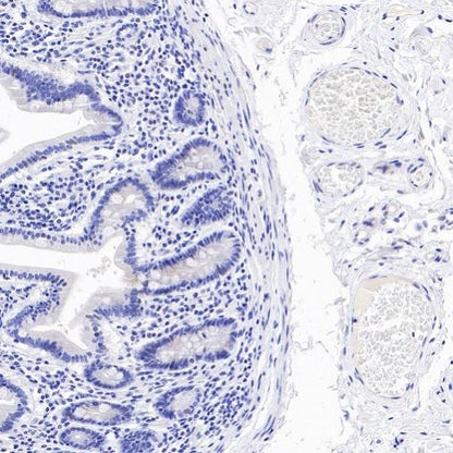 ALPP/ALPPL2 Recombinant Rabbit mAb (S-2089-36)