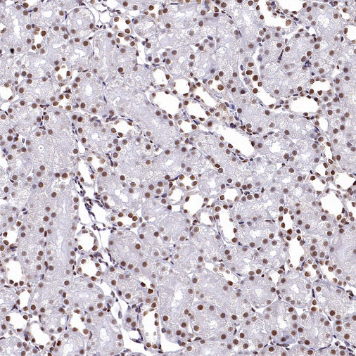 APC6 Recombinant Rabbit mAb (S-2550-48)