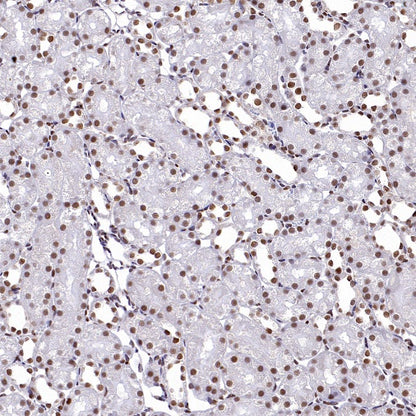 APC6 Recombinant Rabbit mAb (S-2550-48)